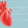 La Falta de Acceso a Alimentos Saludables Puede Aumentar el Riesgo de Muerte por Insuficiencia Cardíaca